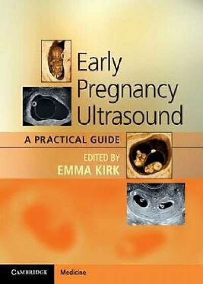 Early Pregnancy Ultrasound: A Practical Guide, Paperback/Emma Kirk