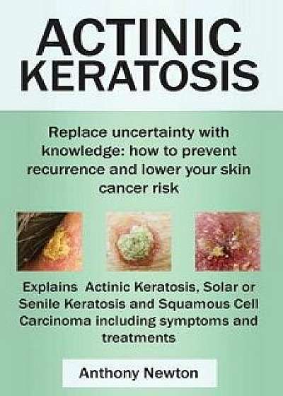 Actinic Keratosis. Replace the Fear and Uncertainty with Knowledge: How to Prevent Recurrence and Lower Your Skin Cancer Risk., Paperback/Anthony Newton