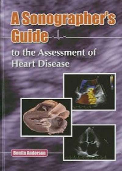 Sonographer's Guide to the Assessment of Heart Disease, Hardcover/Bonita Anderson
