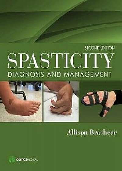 Spasticity: Diagnosis and Management, Hardcover/Allison Brashear
