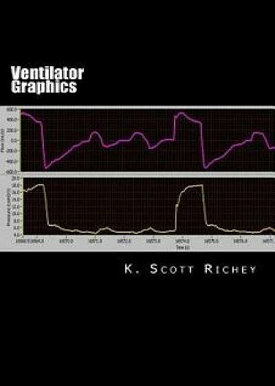 Ventilator Graphics: Identifying Patient Ventilator Asynchrony and Optimizing Settings, Paperback/K. Scott Richey
