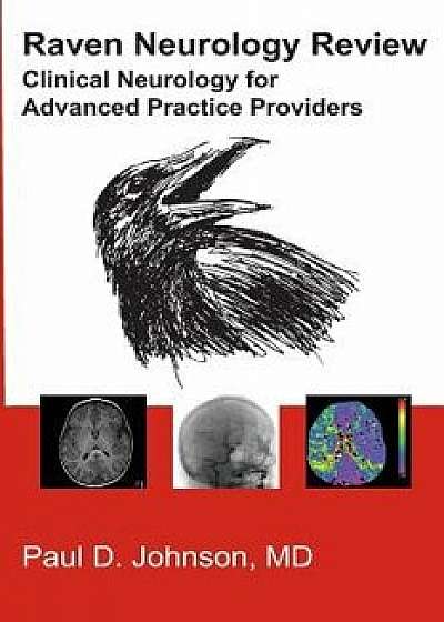 Raven Neurology Review, Paperback/Paul Johnson MD