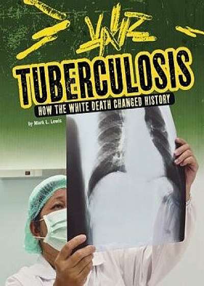 Tuberculosis: How the White Death Changed History/Mark K. Lewis