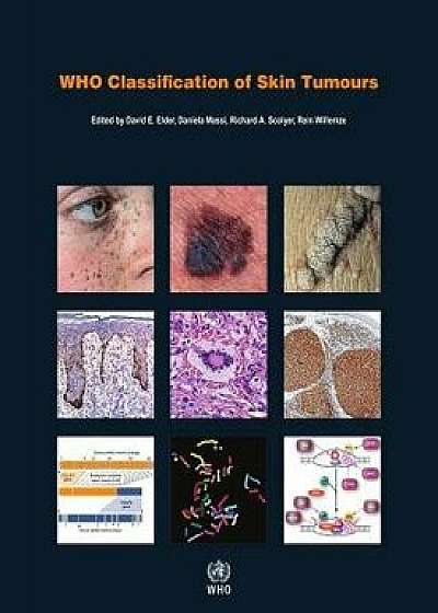 Who Classification of Skin Tumours, Paperback/D. E. Elder