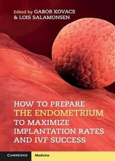 How to Prepare the Endometrium to Maximize Implantation Rates and Ivf Success, Paperback/Gabor Kovacs