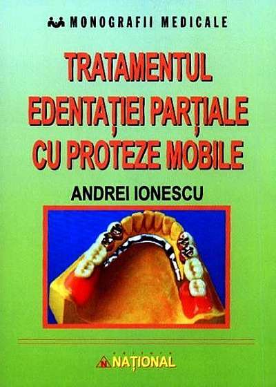 Tratamentul edentației parțiale cu proteze mobile