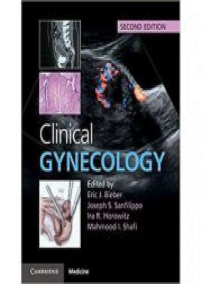 Clinical Gynecology, Joseph S. Sanfilippo, Ira R. Horowitz, Mahmood I. Shafi