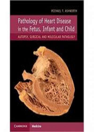 Pathology of Heart Disease in the Fetus, Infant and Child: Autopsy, Surgical and Molecular Pathology