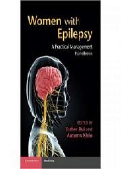 Coperta cărții Women with Epilepsy: A Practical Management Handbook, Autumn M. Klein