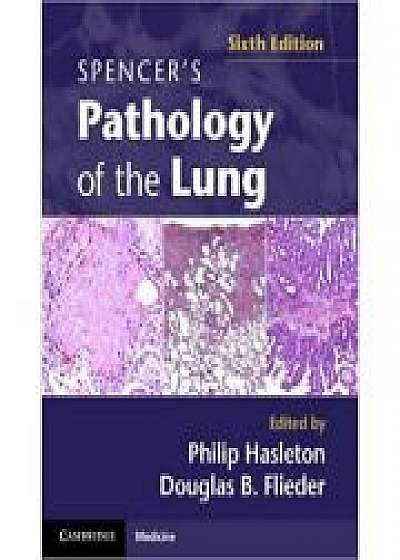 Coperta cărții Spencer's Pathology of the Lung 2 Part Set with DVDs, Dr Douglas B. Flieder MD