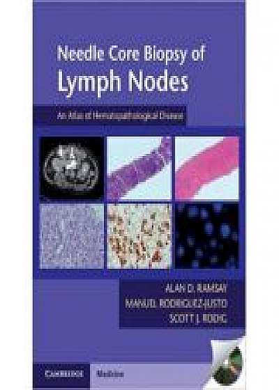 Needle Core Biopsy of Lymph Nodes with DVD-ROM: An Atlas of Hematopathological Disease, Manuel Rodriguez-Justo, Scott J. Rodig