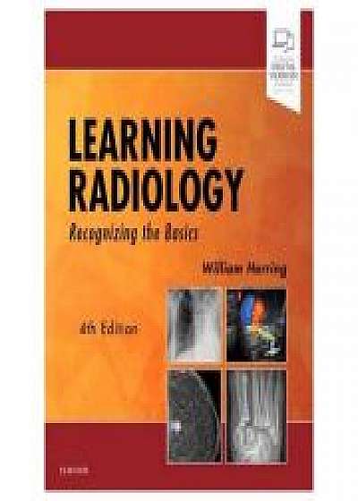 Coperta cărții Learning Radiology: Recognizing the Basics