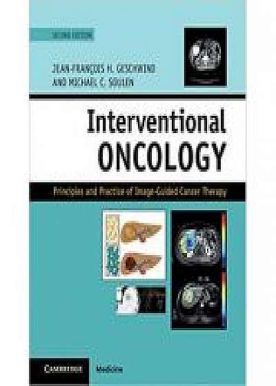 Interventional Oncology: Principles and Practice of Image-Guided Cancer Therapy, Michael C. Soulen