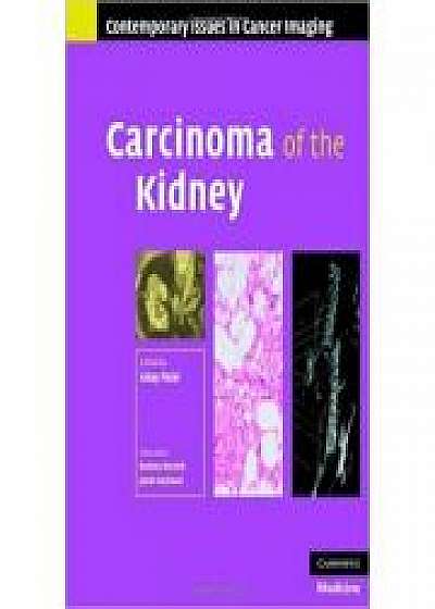 Carcinoma of the Kidney