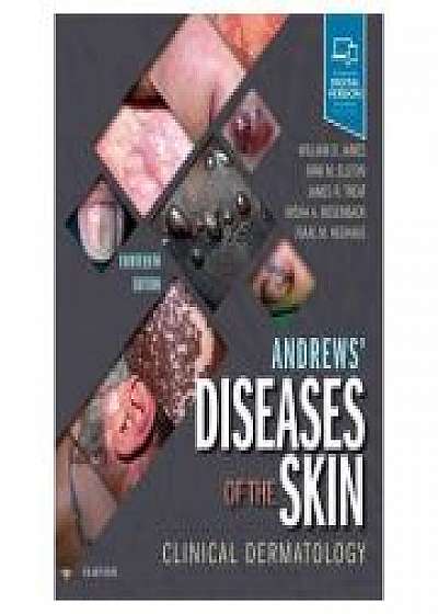 Andrews' Diseases of the Skin. Clinical Dermatology, Dirk Elston, James R. Treat, Misha A. Rosenbach, Isaac Neuhaus