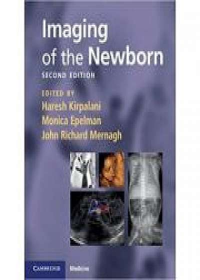 Coperta cărții Imaging of the Newborn, Monica Epelman, John Richard Mernagh