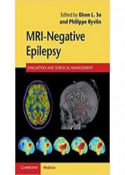 Coperta cărții MRI-Negative Epilepsy: Evaluation and Surgical Management, Philippe Ryvlin