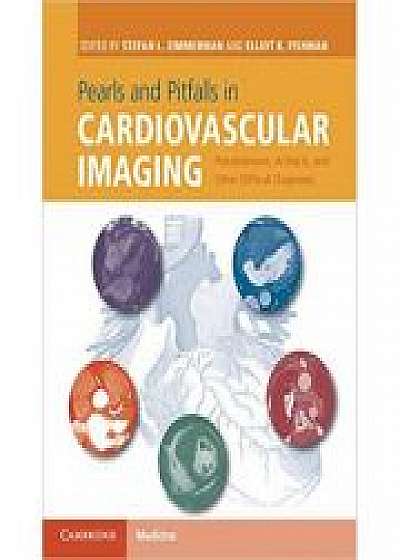 Pearls and Pitfalls in Cardiovascular Imaging: Pseudolesions, Artifacts, and Other Difficult Diagnoses, Elliot K. Fishman