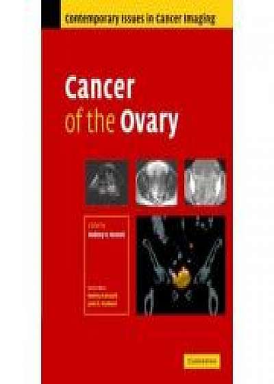 Coperta cărții Cancer of the Ovary de Rodney Reznek