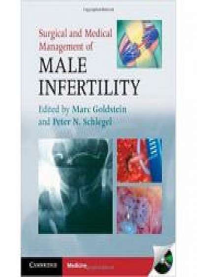 Coperta cărții Surgical and Medical Management of Male Infertility, Peter N. Schlegel MD