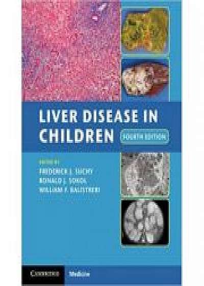 Coperta cărții Liver Disease in Children, Ronald J. Sokol, William F. Balistreri