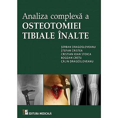 Analiza complexa a Osteotomiei Tibiale Inalte