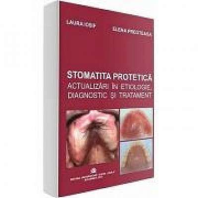 Coperta cărții Stomatita protetica. Actualizari in etiologie, diagnostic si tratament