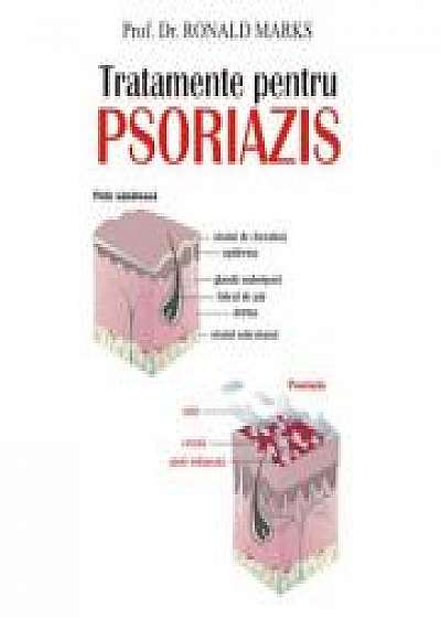 Coperta cărții Tratamente pentru psoriazis - Prof. dr. Ronald Marks