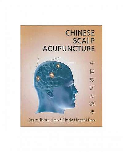 Coperta cărții Chinese Scalp Acupuncture