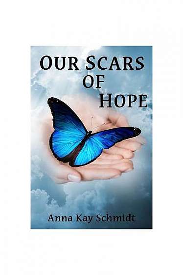 Our Scars of Hope