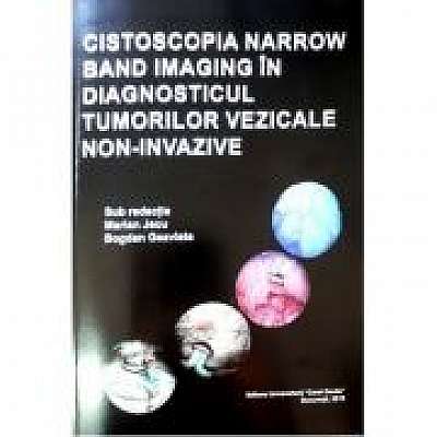 Coperta cărții Cistoscopia narrow band imaging in diagnosticul tumorilor vezicale non-invazive, Bogdan Geavlete de Marian Jecu