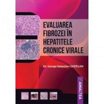 Evaluarea fibrozei in hepatitele cronice virale