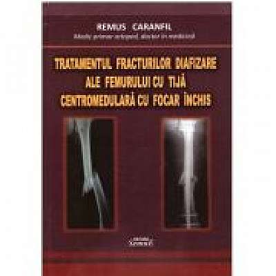 Coperta cărții Tratamentul fracturilor diafizare ale femurului cu tija centromedulara cu focar inchis