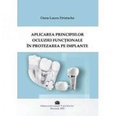 Coperta cărții Aplicarea principiilor ocluziei functonale in protezarea pe implante