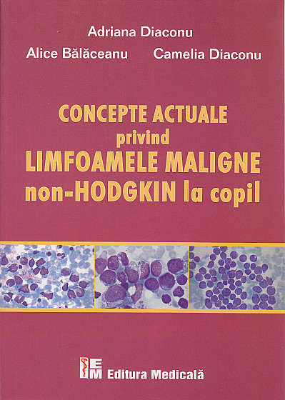 Concepte actuale privind limfoamele maligne Non-Hodgkin la copil
